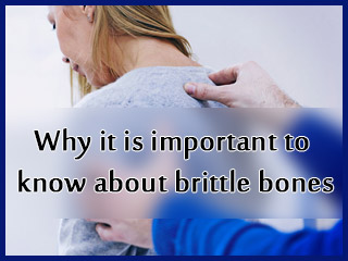Why it is important to know about brittle bones